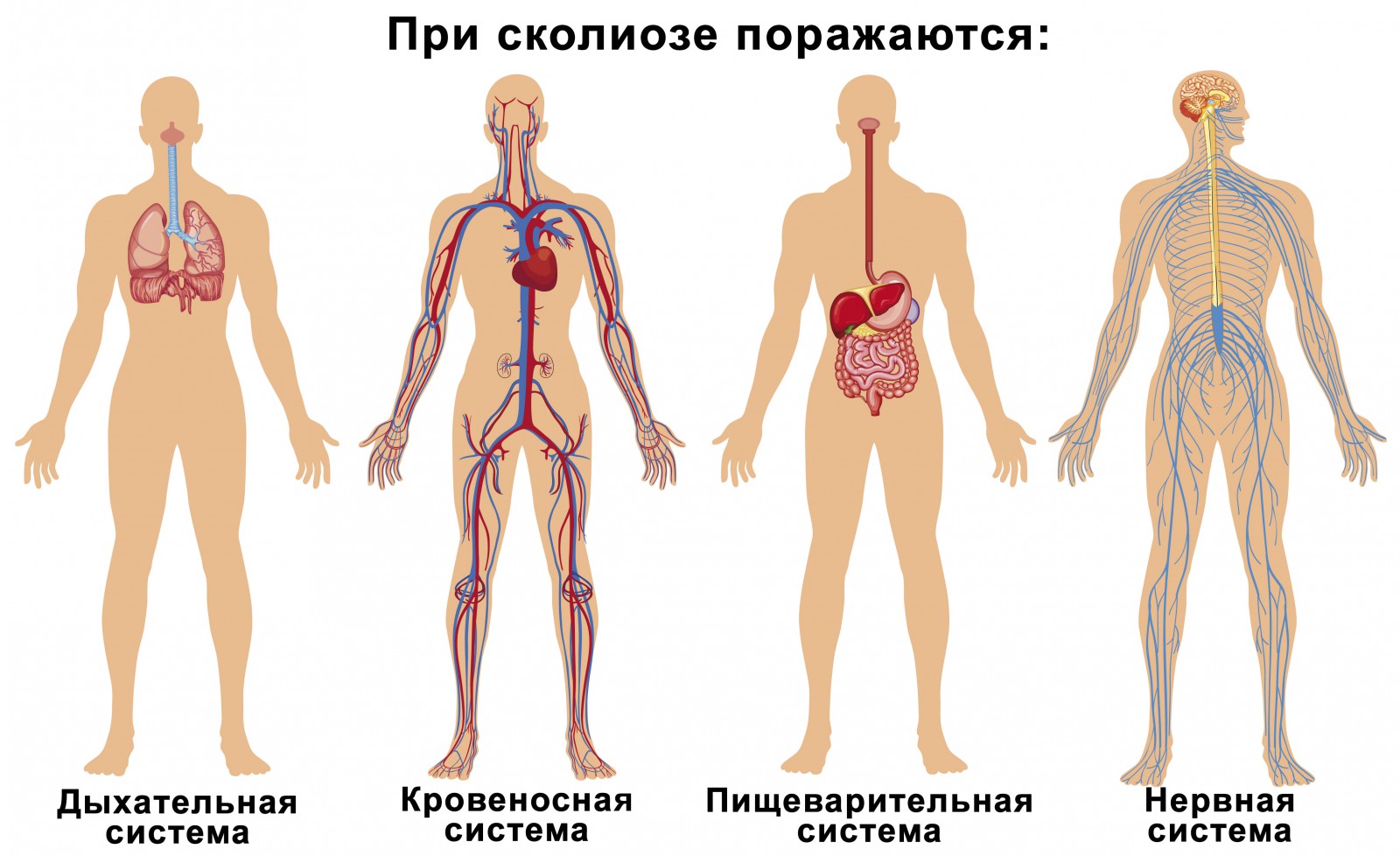 Лечение сколиоза / ИА REX